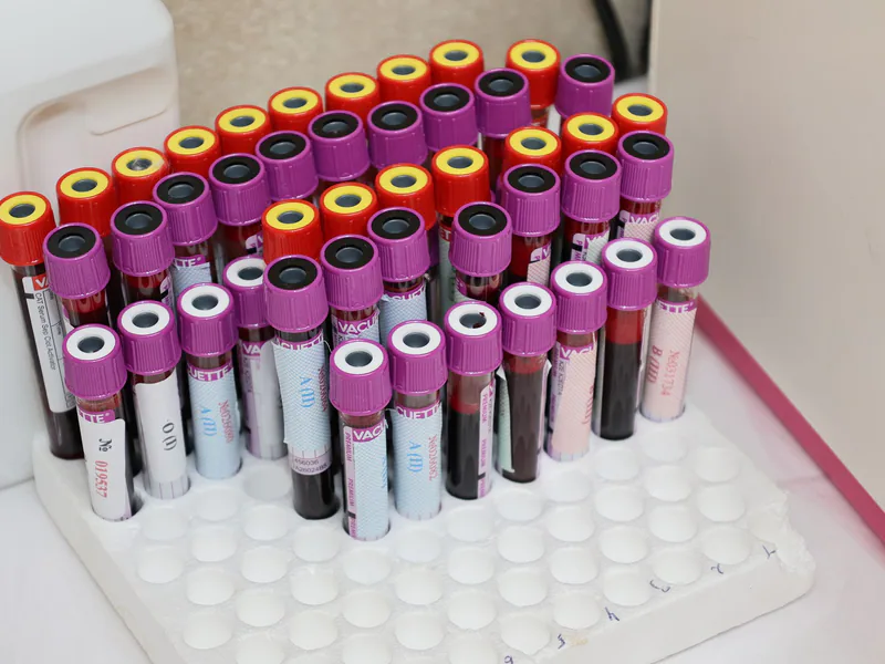 Rows of blood vials in a laboratory setting, ready for analysis